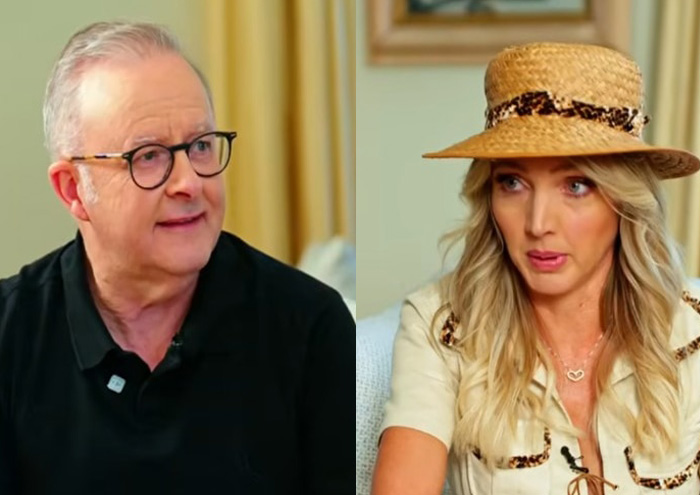 PM Australia Anthony Albanese Minta Maaf usai Komentar tentang Kylie Minogue Tuai Kritik PM Australia Anthony Albanese Minta Maaf usai Komentar tentang Kylie Minogue Tuai Kritik